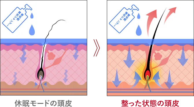 休眠モードの頭皮 / 整った状態の頭皮イメージ図