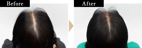 木村さんBefore/AFter