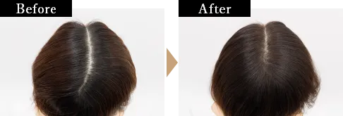 荻原さんBefore/AFter