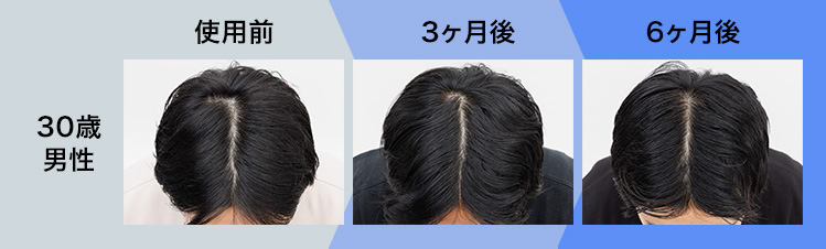 30歳男性